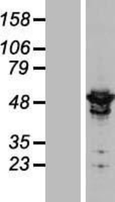 Western Blot: ARHGAP1 Overexpression Lysate (Adult Normal) [NBL1-07665] Left-Empty vector transfected control cell lysate (HEK293 cell lysate); Right -Over-expression Lysate for ARHGAP1.