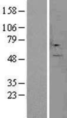 Western Blot: CSAD Overexpression Lysate (Adult Normal) [NBL1-09507] Left-Empty vector transfected control cell lysate (HEK293 cell lysate); Right -Over-expression Lysate for CSAD.