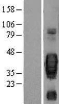Western Blot: SCF Overexpression Lysate (Adult Normal) [NBL1-12306] Left-Empty vector transfected control cell lysate (HEK293 cell lysate); Right -Over-expression Lysate for SCF.