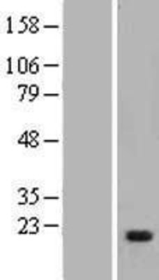 Western Blot: Myosin light chain kinase Overexpression Lysate (Adult Normal) [NBP2-05825] Left-Empty vector transfected control cell lysate (HEK293 cell lysate); Right -Over-expression Lysate for Myosin light chain kinase.