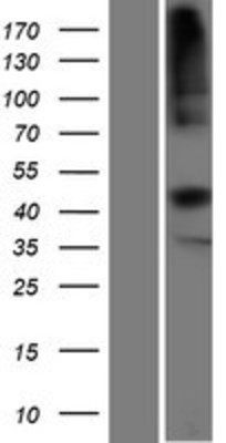 Western Blot: TCN2 Overexpression Lysate (Adult Normal) [NBP2-10251] Left-Empty vector transfected control cell lysate (HEK293 cell lysate); Right -Over-expression Lysate for TCN2.