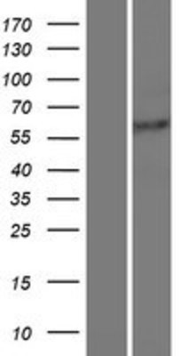 Western Blot: ROD1 Overexpression Lysate (Adult Normal) [NBP2-10152] Left-Empty vector transfected control cell lysate (HEK293 cell lysate); Right -Over-expression Lysate for ROD1.