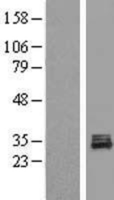 Western Blot: POLR3GL Overexpression Lysate (Adult Normal) [NBL1-14594] Left-Empty vector transfected control cell lysate (HEK293 cell lysate); Right -Over-expression Lysate for POLR3GL.