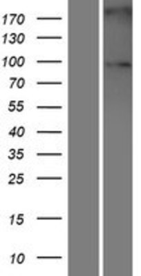 Western Blot: Sulfatase 2 Overexpression Lysate (Adult Normal) [NBL1-16599] Left-Empty vector transfected control cell lysate (HEK293 cell lysate); Right -Over-expression Lysate for Sulfatase 2.