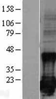 Western Blot: Survivin Overexpression Lysate (Adult Normal) [NBL1-07987] Left-Empty vector transfected control cell lysate (HEK293 cell lysate); Right -Over-expression Lysate for Survivin.