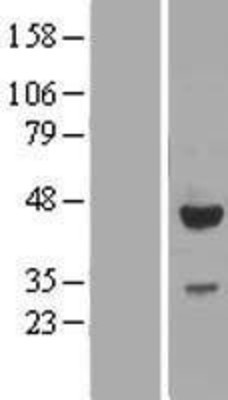 Western Blot: EFCAB4B Overexpression Lysate (Adult Normal) [NBP2-05981] Left-Empty vector transfected control cell lysate (HEK293 cell lysate); Right -Over-expression Lysate for EFCAB4B.