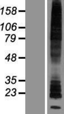Western Blot: HRH2 Overexpression Lysate (Adult Normal) [NBP2-06453] Left-Empty vector transfected control cell lysate (HEK293 cell lysate); Right -Over-expression Lysate for HRH2.
