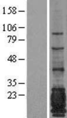 Western Blot: MUC1 Overexpression Lysate (Adult Normal) [NBL1-13391] Left-Empty vector transfected control cell lysate (HEK293 cell lysate); Right -Over-expression Lysate for MUC1.