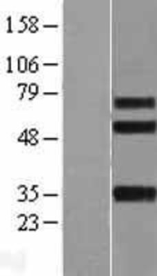 Western Blot: Integrin beta-like protein 1 Overexpression Lysate (Adult Normal) [NBL1-12077] Left-Empty vector transfected control cell lysate (HEK293 cell lysate); Right -Over-expression Lysate for Integrin beta-like protein 1.