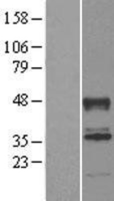 Western Blot: ABHD2 Overexpression Lysate (Adult Normal) [NBL1-07195] Left-Empty vector transfected control cell lysate (HEK293 cell lysate); Right -Over-expression Lysate for ABHD2.