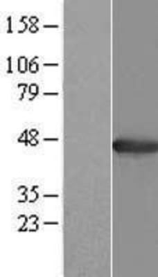 Western Blot: AGXT Overexpression Lysate (Adult Normal) [NBP2-09062] Left-Empty vector transfected control cell lysate (HEK293 cell lysate); Right -Over-expression Lysate for AGXT.