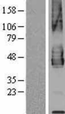 Western Blot: PDCD1LG2 Overexpression Lysate (Adult Normal) [NBP2-06213] Left-Empty vector transfected control cell lysate (HEK293 cell lysate); Right -Over-expression Lysate for PDCD1LG2.