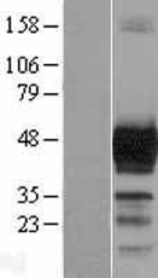 Western Blot: Doublecortin Overexpression Lysate (Adult Normal) [NBL1-09761] Left-Empty vector transfected control cell lysate (HEK293 cell lysate); Right -Over-expression Lysate for Doublecortin.
