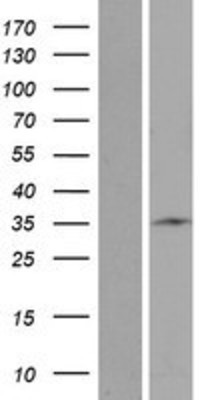 Western Blot: STARD6 Overexpression Lysate (Adult Normal) [NBP2-05592] Left-Empty vector transfected control cell lysate (HEK293 cell lysate); Right -Over-expression Lysate for STARD6.