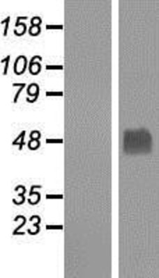 Western Blot: Gabpb2 Overexpression Lysate (Adult Normal) [NBP2-05555] Left-Empty vector transfected control cell lysate (HEK293 cell lysate); Right -Over-expression Lysate for Gabpb2.