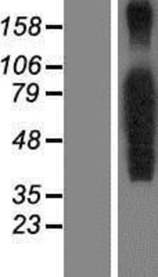 Western Blot: FOXP4 Overexpression Lysate (Adult Normal) [NBP2-05654] Left-Empty vector transfected control cell lysate (HEK293 cell lysate); Right -Over-expression Lysate for FOXP4.