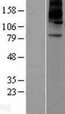 Western Blot: ATP12A Overexpression Lysate (Adult Normal) [NBL1-07806] Left-Empty vector transfected control cell lysate (HEK293 cell lysate); Right -Over-expression Lysate for ATP12A.