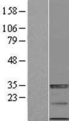 Western Blot: RAET1E Overexpression Lysate (Adult Normal) [NBP2-05589] Left-Empty vector transfected control cell lysate (HEK293 cell lysate); Right -Over-expression Lysate for RAET1E.