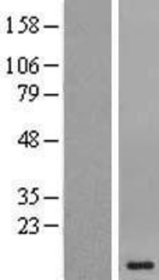 Western Blot: HOP Overexpression Lysate (Adult Normal) [NBP2-05585] Left-Empty vector transfected control cell lysate (HEK293 cell lysate); Right -Over-expression Lysate for HOP.