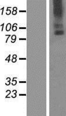 Western Blot: TMC6 Overexpression Lysate (Adult Normal) [NBP2-09429] Left-Empty vector transfected control cell lysate (HEK293 cell lysate); Right -Over-expression Lysate for TMC6.
