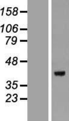 Western Blot: DEDD Overexpression Lysate (Adult Normal) [NBP2-09207] Left-Empty vector transfected control cell lysate (HEK293 cell lysate); Right -Over-expression Lysate for DEDD.