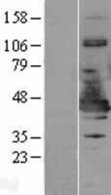 Western Blot: NDE1 Overexpression Lysate (Adult Normal) [NBP2-09701] Left-Empty vector transfected control cell lysate (HEK293 cell lysate); Right -Over-expression Lysate for NDE1.
