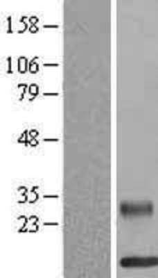 Western Blot: RELM beta Overexpression Lysate (Adult Normal) [NBL1-15288] Left-Empty vector transfected control cell lysate (HEK293 cell lysate); Right -Over-expression Lysate for RELM beta.