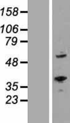 Western Blot: ROR alpha Overexpression Lysate (Adult Normal) [NBP2-05658] Left-Empty vector transfected control cell lysate (HEK293 cell lysate); Right -Over-expression Lysate for ROR alpha.