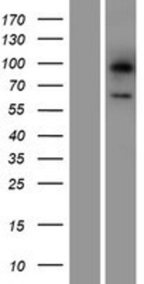 Western Blot: Lgi3 Overexpression Lysate (Adult Normal) [NBP2-05574] Left-Empty vector transfected control cell lysate (HEK293 cell lysate); Right -Over-expression Lysate for Lgi3.