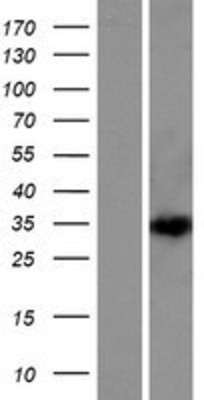 Western Blot: DEPDC4 Overexpression Lysate (Adult Normal) [NBP2-05403] Left-Empty vector transfected control cell lysate (HEK293 cell lysate); Right -Over-expression Lysate for DEPDC4.