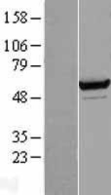 Western Blot: Seryl tRNA synthetase Overexpression Lysate (Adult Normal) [NBL1-15694] Left-Empty vector transfected control cell lysate (HEK293 cell lysate); Right -Over-expression Lysate for Seryl tRNA synthetase.