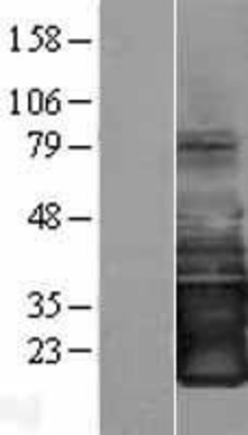 Western Blot: SMAGP Overexpression Lysate (Adult Normal) [NBP2-09191] Left-Empty vector transfected control cell lysate (HEK293 cell lysate); Right -Over-expression Lysate for SMAGP.