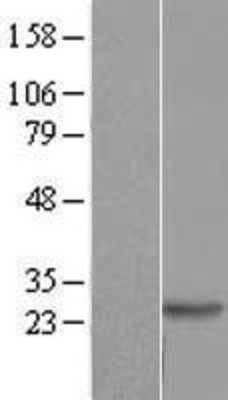 Western Blot: DIRAS2 Overexpression Lysate (Adult Normal) [NBL1-09890] Left-Empty vector transfected control cell lysate (HEK293 cell lysate); Right -Over-expression Lysate for DIRAS2.