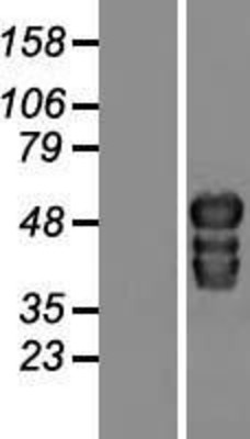 Western Blot: TOX2 Overexpression Lysate (Adult Normal) [NBP2-09307] Left-Empty vector transfected control cell lysate (HEK293 cell lysate); Right -Over-expression Lysate for TOX2.