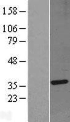 Western Blot: SIP1 Overexpression Lysate (Adult Normal) [NBL1-15969] Left-Empty vector transfected control cell lysate (HEK293 cell lysate); Right -Over-expression Lysate for SIP1.