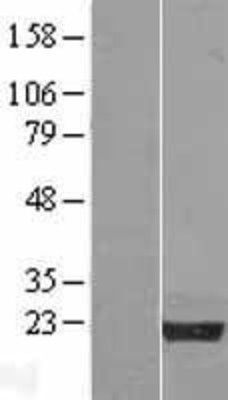 Western Blot: Nucleoplasmin-3 Overexpression Lysate (Adult Normal) [NBL1-13751] Left-Empty vector transfected control cell lysate (HEK293 cell lysate); Right -Over-expression Lysate for Nucleoplasmin-3.