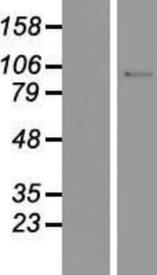 Western Blot: DNA Ligase I Overexpression Lysate (Adult Normal) [NBP2-11159] Left-Empty vector transfected control cell lysate (HEK293 cell lysate); Right -Over-expression Lysate for DNA Ligase I.