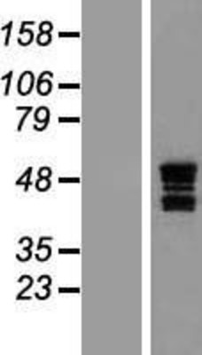 Western Blot: ASAHL Overexpression Lysate (Adult Normal) [NBP2-10321] Left-Empty vector transfected control cell lysate (HEK293 cell lysate); Right -Over-expression Lysate for ASAHL.