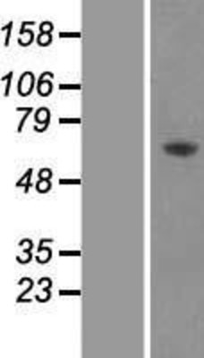 Western Blot: AMPK alpha 2 Overexpression Lysate (Adult Normal) [NBP2-10422] Left-Empty vector transfected control cell lysate (HEK293 cell lysate); Right -Over-expression Lysate for AMPK alpha 2.