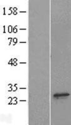 Western Blot: POLR2E Overexpression Lysate (Adult Normal) [NBL1-14582] Left-Empty vector transfected control cell lysate (HEK293 cell lysate); Right -Over-expression Lysate for POLR2E.