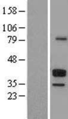 Western Blot: CD23 Overexpression Lysate (Adult Normal) [NBL1-10652] Left-Empty vector transfected control cell lysate (HEK293 cell lysate); Right -Over-expression Lysate for CD23.