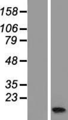 Western Blot: APITD1 Overexpression Lysate (Adult Normal) [NBL1-07604] Left-Empty vector transfected control cell lysate (HEK293 cell lysate); Right -Over-expression Lysate for APITD1.