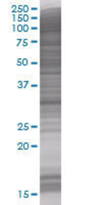 CA7 transfected lysate.