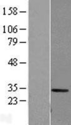 Western Blot: Carbonic Anhydrase I Overexpression Lysate (Adult Normal) [NBP2-11112] Left-Empty vector transfected control cell lysate (HEK293 cell lysate); Right -Over-expression Lysate for Carbonic Anhydrase I.
