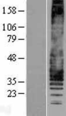 Western Blot: Leukotriene B4 Receptor 1 Overexpression Lysate (Adult Normal) [NBP2-11364] Left-Empty vector transfected control cell lysate (HEK293 cell lysate); Right -Over-expression Lysate for Leukotriene B4 Receptor 1.
