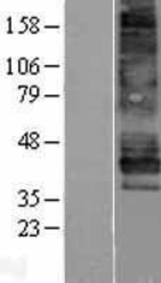 Western Blot: Endothelin B Receptor Overexpression Lysate (Adult Normal) [NBP2-11403] Left-Empty vector transfected control cell lysate (HEK293 cell lysate); Right -Over-expression Lysate for Endothelin B Receptor.