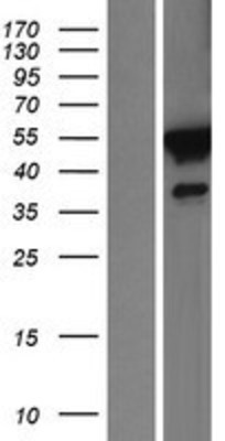 Western Blot: FKBP5/FKBP51 Overexpression Lysate (Adult Normal) [NBP2-11340] Left-Empty vector transfected control cell lysate (HEK293 cell lysate); Right -Over-expression Lysate for FKBP5/FKBP51.