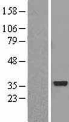 Western Blot: AKR1C2 Overexpression Lysate (Adult Normal) [NBL1-07435] Left-Empty vector transfected control cell lysate (HEK293 cell lysate); Right -Over-expression Lysate for AKR1C2.