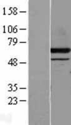 Western Blot: DPP2 Overexpression Lysate (Adult Normal) [NBL1-09998] Left-Empty vector transfected control cell lysate (HEK293 cell lysate); Right -Over-expression Lysate for DPP2.