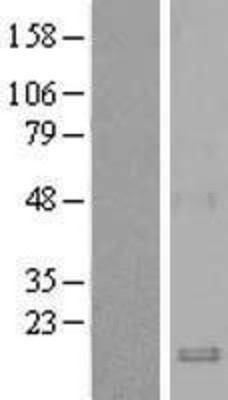 Western Blot: Macrophage Inflammatory Protein 3 beta Overexpression Lysate (Adult Normal) [NBL1-08848] Left-Empty vector transfected control cell lysate (HEK293 cell lysate); Right -Over-expression Lysate for Macrophage Inflammatory Protein 3 beta.